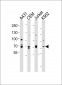 ITK Antibody (Center)