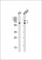 ASH2L Antibody (Center)