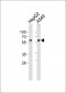 USP22 Antibody (C-term)