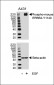 Phospho-M ERBB2(Y1140) Antibody