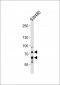 PCSK9 Antibody (N-term)