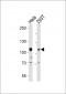 EPHA10 Antibody (N-term)