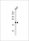 HRAS Antibody (Center)