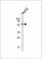 NR1H2 Antibody (N-term)