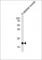 COX6A2 Antibody (Center)