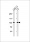 Musk Antibody