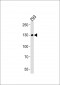 EPHA6 Antibody