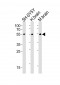 CHRM2 Antibody