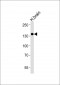 Ntrk3 Antibody