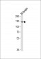 Tyro3 Antibody