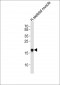 TP53INP1 Antibody (N-term)