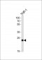 PYCARD Antibody (C-term)