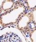 AK4 Antibody (Center)