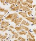 AK4 Antibody (Center)