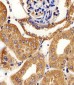 AK4 Antibody (Center)