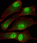 MORC2 Antibody (C-term)