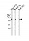 CNDP1 Antibody (Center)