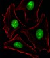 PTK2B Antibody (C-term)