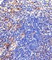 Lyn Antibody (Center)