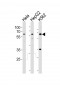 RIOK3 Antibody  (Center)