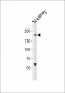 Mouse Erbb2 Antibody (P1142)