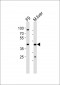 (Mouse) Ubtfl1 Antibody (Center)