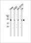 PAFAH1B1 Antibody (N-term)