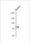 BTK Antibody (Center)