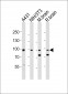 Mouse Ephb1 Antibody (Center)