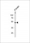 HCRTR1 Antibody (Center)