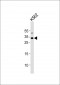 TAL1 Antibody (C-term)