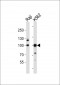 KDM1B Antibody (N-term)