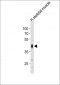 POU5F1B Antibody (N-term)