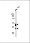 SULT1A1 Antibody (C-term)