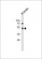 PIP4K2A Antibody (C-term)