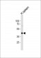 CHST12 Antibody (N-term)