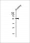 NACC1 Antibody (Center)