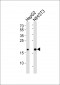 Mouse Hmga2 Antibody (N-term)