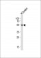 PIP4K2A Antibody (C-term)