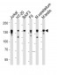 Mouse Ctr9 Antibody (C-term)