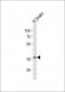 UTF1 Antibody (Center)