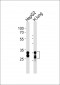 SULT1A1 Antibody (C-term)