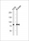 ACAP2 Antibody (Center)