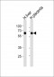 SCP2 Antibody (C-term)