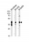 (Mouse) Epcam Antibody (C-term)