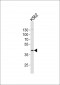 CHST11 Antibody (Center)