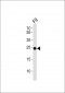 (Mouse) Eras Antibody (N-term)