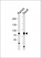 TEC Antibody (Center)