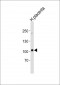 ENG Antibody (Center)