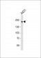 TJP1 Antibody (C-term)